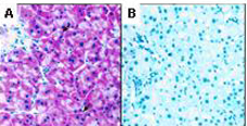 Mouse Anti-ABCA1 Immunoreactivity Mouse Anti-ABCA1 Immunoreactivity