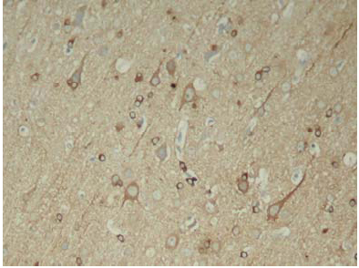 Rabbit Anti-Tau (Phospho-Ser396) Polyclonal Antibody IHC