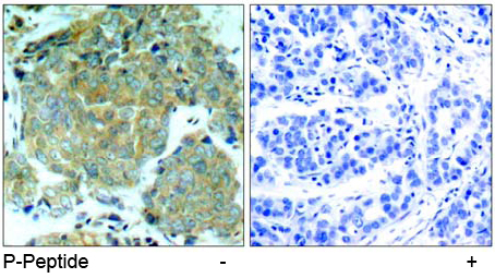 Rabbit Anti-eIF2α (Phospho-Ser51) Polyclonal Antibody IHC Rabbit Anti-eIF2α (Phospho-Ser51) Polyclonal Antibody IHC