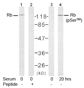 Rabbit Anti-Rb (Ab-780) Polyclonal Antibody WB Rabbit Anti-Rb (Ab-780) Polyclonal Antibody WB