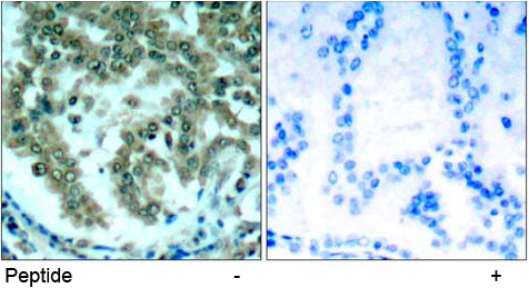 Rabbit Anti-PKCθ (Ab-676) Polyclonal Antibody IHC Rabbit Anti-PKCθ (Ab-676) Polyclonal Antibody IHC