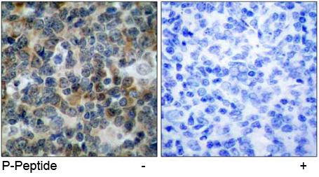 Rabbit Anti-VASP (Phospho-Ser238) Polyclonal Antibody IHC Rabbit Anti-VASP (Phospho-Ser238) Polyclonal Antibody IHC