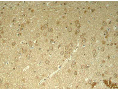 Rabbit Anti-Tau (Phospho-Thr205) Polyclonal Antibody IHC Rabbit Anti-Tau (Phospho-Thr205) Polyclonal Antibody IHC
