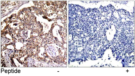 Rabbit Anti-SEK1/MKK4 (Ab-80) Polyclonal Antibody IHC Rabbit Anti-SEK1/MKK4 (Ab-80) Polyclonal Antibody IHC