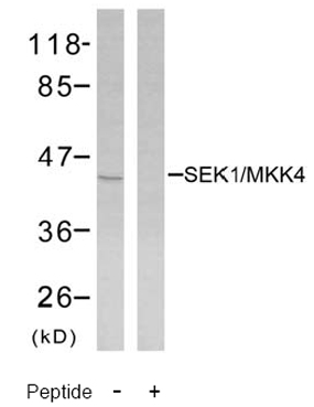 Rabbit Anti-SEK1/MKK4 (Ab-80) Polyclonal Antibody WB Rabbit Anti-SEK1/MKK4 (Ab-80) Polyclonal Antibody WB