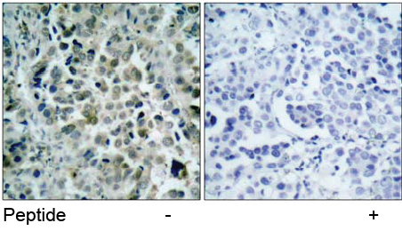 Rabbit Anti-HDAC8 (Ab-39) Polyclonal Antibody IHC Rabbit Anti-HDAC8 (Ab-39) Polyclonal Antibody IHC