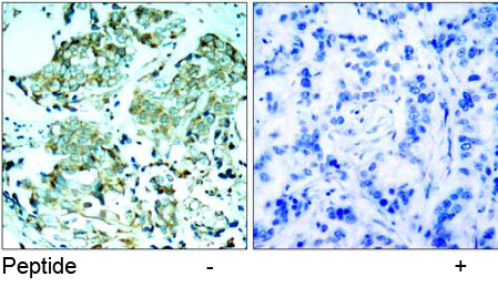 Rabbit Anti-EGFR (Ab-1110) Polyclonal Antibody IHC Rabbit Anti-EGFR (Ab-1110) Polyclonal Antibody IHC