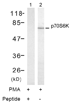 Rabbit Anti-p70 S6 Kinase (Ab-421) Polyclonal Antibody WB Rabbit Anti-p70 S6 Kinase (Ab-421) Polyclonal Antibody WB