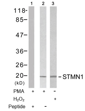 Rabbit Anti-Stathmin 1 (Ab-15) Polyclonal Antibody WB Rabbit Anti-Stathmin 1 (Ab-15) Polyclonal Antibody WB
