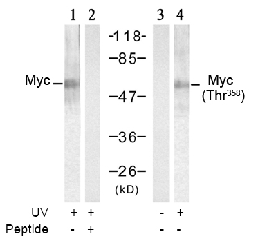 Rabbit Anti-Myc (Phospho-Thr358) Polyclonal Antibody WB Rabbit Anti-Myc (Phospho-Thr358) Polyclonal Antibody WB