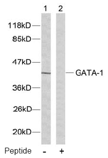 Rabbit Anti-GATA1 (Ab-142) Polyclonal Antibody WB Rabbit Anti-GATA1 (Ab-142) Polyclonal Antibody WB