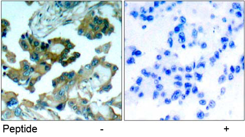 Rabbit Anti-FAK (Ab-861) Polyclonal Antibody IHC