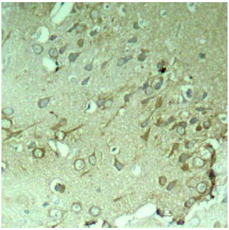 Rabbit Anti-Tau (Ab-396) Polyclonal Antibody IHC