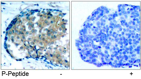 Rabbit Anti-Ezrin (Phospho-Tyr353) Polyclonal Antibody IHC