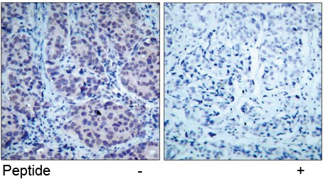 Rabbit Anti-HDAC2 (Ab-394) Polyclonal Antibody IHC Rabbit Anti-HDAC2 (Ab-394) Polyclonal Antibody IHC