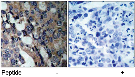 Rabbit Anti-HSP27 (Ab-15) Polyclonal Antibody IHC