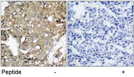 Rabbit Anti-STAT1 (Ab-727) Polyclonal Antibody IHC