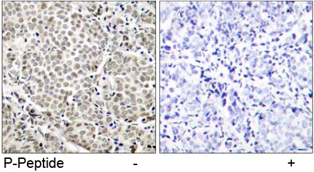 Rabbit Anti-NF-κB p65 (Phospho-Ser529) Polyclonal Antibody IHC Rabbit Anti-NF-κB p65 (Phospho-Ser529) Polyclonal Antibody IHC