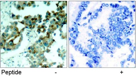Rabbit Anti-S6 Ribosomal Protein (Ab-235) Polyclonal Antibody IHC Rabbit Anti-S6 Ribosomal Protein (Ab-235) Polyclonal Antibody IHC