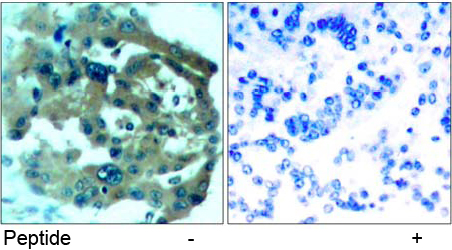 Rabbit Anti-Merlin (Ab-518) Polyclonal Antibody IHC