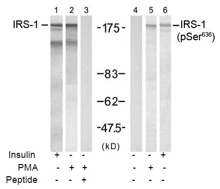Rabbit Anti-IRS-1 (Phospho-Ser636) Polyclonal Antibody WB Rabbit Anti-IRS-1 (Phospho-Ser636) Polyclonal Antibody WB