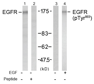 Rabbit Anti-EGFR (Phospho-Tyr869) Polyclonal Antibody WB