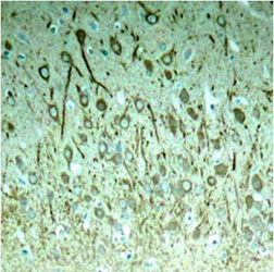 Rabbit Anti-Tau (Phospho-Thr231) IHC Rabbit Anti-Tau (Phospho-Thr231) IHC