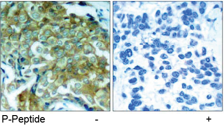 Rabbit Anti-EGFR (Phospho-Tyr1172) Polyclonal Antibody IHC