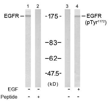 Rabbit Anti-EGFR (Phospho-Tyr1172) Polyclonal Antibody WB