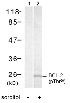 Rabbit Anti-BCL-2 (Phospho-Thr56) Polyclonal Antibody width="200" border=0></a><br><a href="http://www.genscript.com/ssl-bin/site2/show_image.cgi?op=5658" target="_blank">Zoom</a><br></td></tr><tr height=45 background="/images/cgi2007/titlebg2.gif" bgColor= Rabbit Anti-BCL-2 (Phospho-Thr56) Polyclonal Antibody