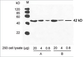 THETM Anti-β-actin loading_control