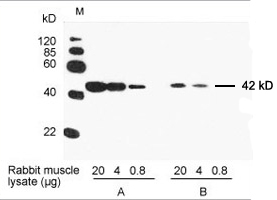THETM Anti-β-actin mAb