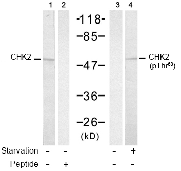 Rabbit Anti-Chk2 (Ab-68) Polyclonal Antibody WB