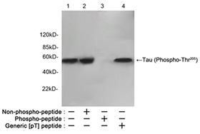 Rabbit Anti-Tau (Phospho-Thr205) Polyclonal Antibody Rabbit Anti-Tau (Phospho-Thr205) Polyclonal Antibody