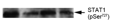 Rabbit Anti-STAT1 (Phospho-Ser727) Polyclonal Antibody WB Rabbit Anti-STAT1 (Phospho-Ser727) Polyclonal Antibody WB