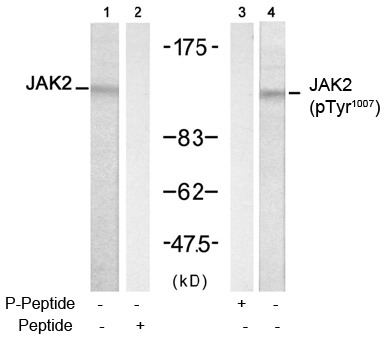 Rabbit Anti-JAK2 (Phospho-Tyr1007) Polyclonal Antibody WB Rabbit Anti-JAK2 (Phospho-Tyr1007) Polyclonal Antibody WB