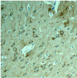 Rabbit Anti-Tau (Ab-231) Polyclonal Antibody IHC