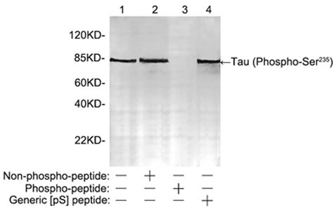 Rabbit Anti-Tau (Phospho-Ser235) Polyclonal Antibody WB Rabbit Anti-Tau (Phospho-Ser235) Polyclonal Antibody WB