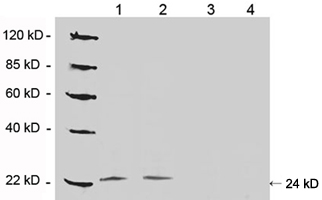 Rabbit Anti-DJ-1 Polyclonal Antibody WB1