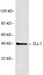 Rabbit Anti-DJ-1 Polyclonal Antibody WB2