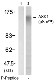 Rabbit Anti-ASK1 (Phospho-Ser966) Polyclonal Antibody WB