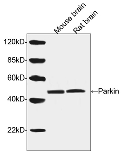 Rabbit Anti-Parkin Polyclonal Antibody WB