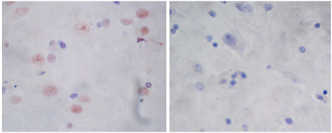 Rabbit Anti-Parkin Polyclonal Antibody IHC