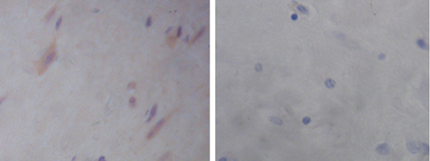 Rabbit Anti-Calbindin Polyclonal Antibody IHC