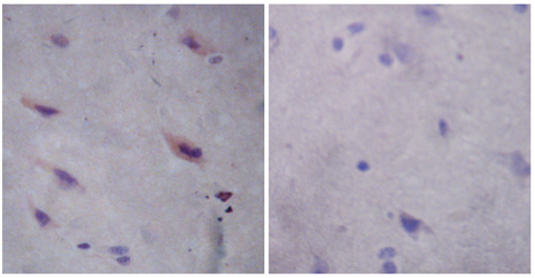 Rabbit Anti-DJ-1 Polyclonal Antibody IHC
