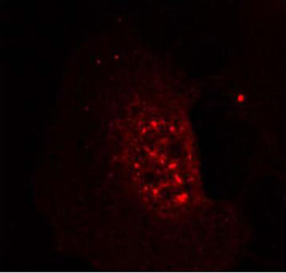 Rabbit Anti-Akt (Phospho-Thr308) Polyclonal Antibody Rabbit Anti-Akt (Phospho-Thr308) Polyclonal Antibody IF