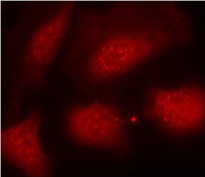 Rabbit Anti-Histone H3.1 (Phospho-Ser10) Polyclonal Antibody Rabbit Anti-Histone H3.1 (Phospho-Ser10) Polyclonal Antibody IF