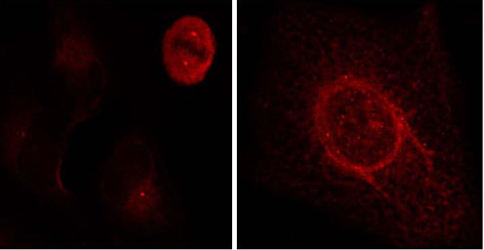 Rabbit Anti-p44/42 MAP Kinase (Phospho-Tyr204) Polyclonal Antibody IF