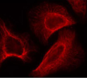 Rabbit Anti-p70 S6 Kinase (Phospho-Ser424) Polyclonal Antibody IF