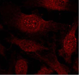 Rabbit Anti-GSK3β (Ab-9) Polyclonal Antibody IF